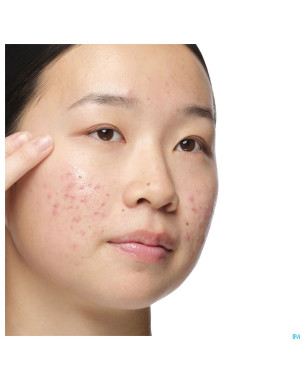 The ordinary aloe 2% + nag 2% solution 30ml