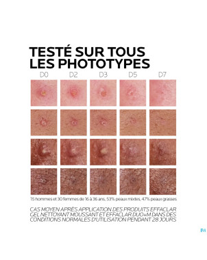 Lrp effaclar duo + m creme    40ml