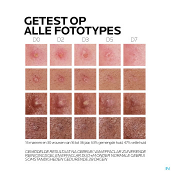 Lrp effaclar duo + m creme    40ml