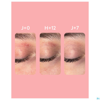 Svr topialyse palpebral baume 30ml