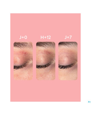 Svr topialyse palpebral baume 30ml