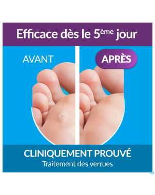 Excilor traitement verrues duo power 10ml+1,5g