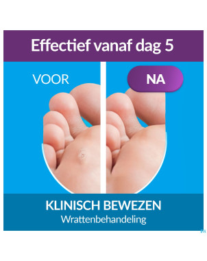 Excilor traitement verrues duo power 10ml+1,5g