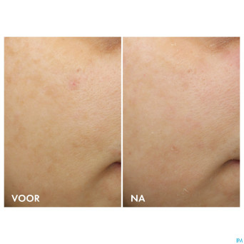 Vichy liftactiv b3 cr teint nuit retinol pur 50ml