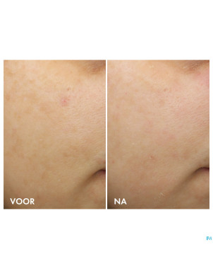 Vichy liftactiv b3 cr teint nuit retinol pur 50ml