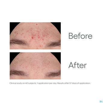 Aderma biology ac night peel serum a/imperf.  30ml