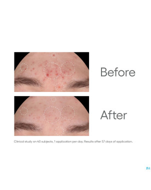 Aderma biology ac night peel serum a/imperf.  30ml