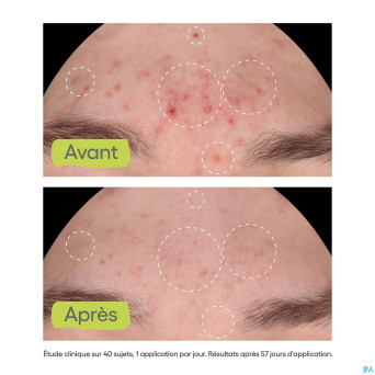 Aderma biology ac night peel serum a/imperf.  30ml