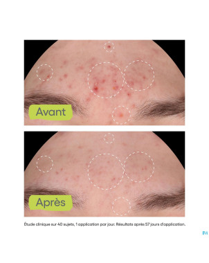 Aderma biology ac night peel serum a/imperf.  30ml