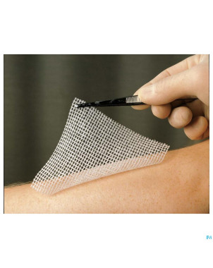 Lomatuell h compresse ster 10x10cm 10 23315