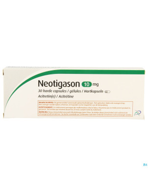 Neotigason caps  30x10mg
