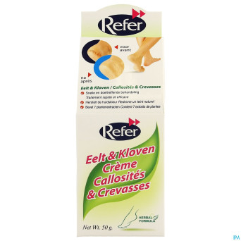 Refer creme tallon crevasse tube 50g